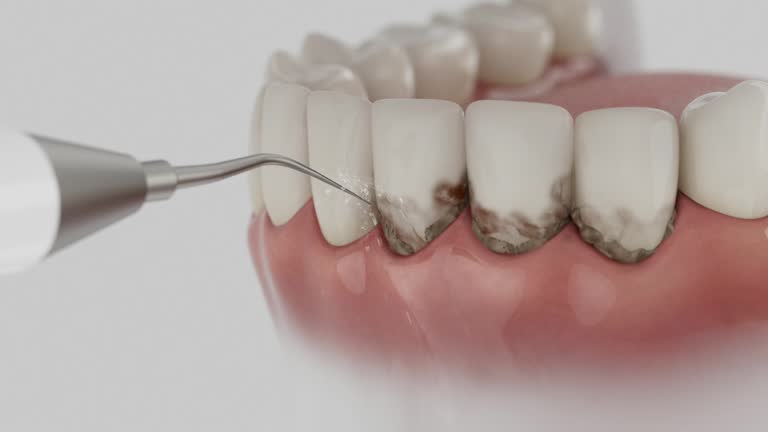 Reliable Dental Implants contractor in Caruthers, CA by Smile Center Dentistry